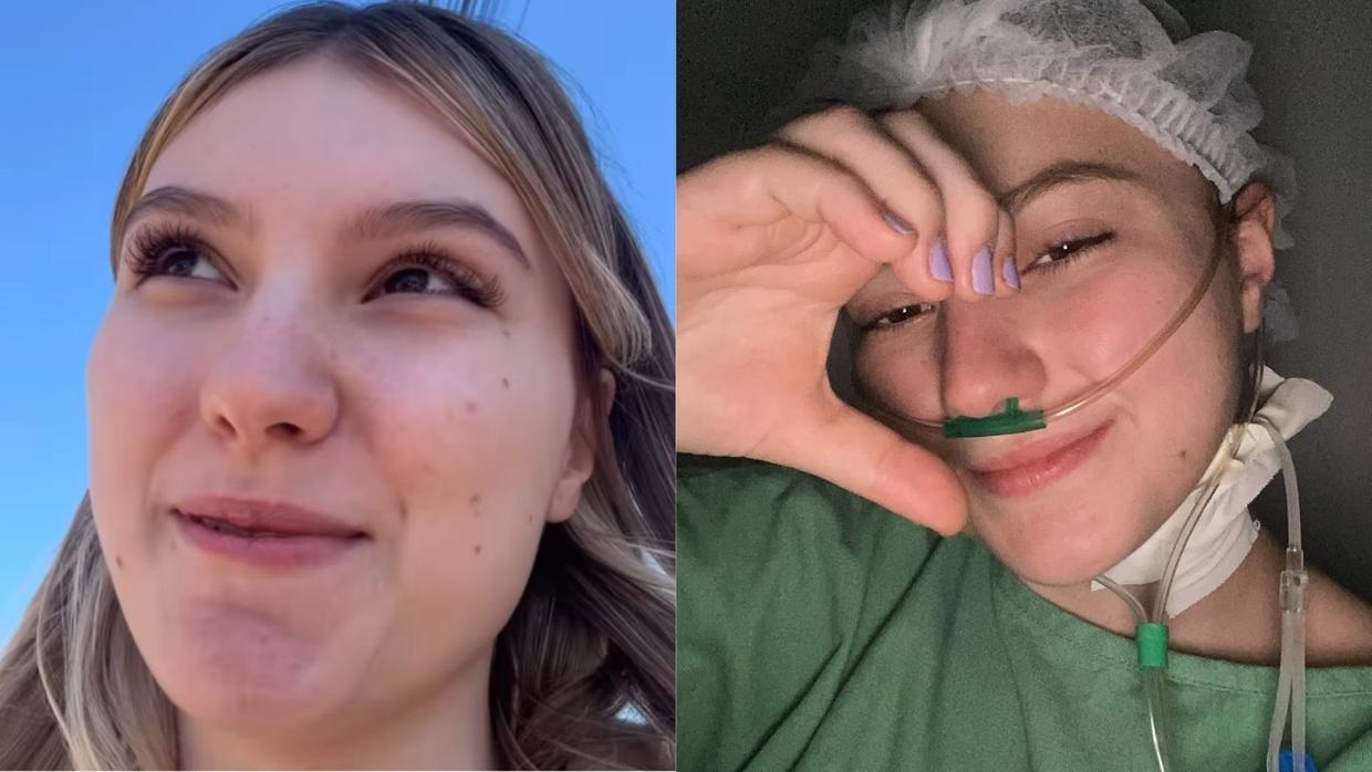 montagem duas fotos da influenciadora isabel veloso. uma ela com cabelo e uma no hospital. Imagem usada em matéria sobre cuidado paliativo.