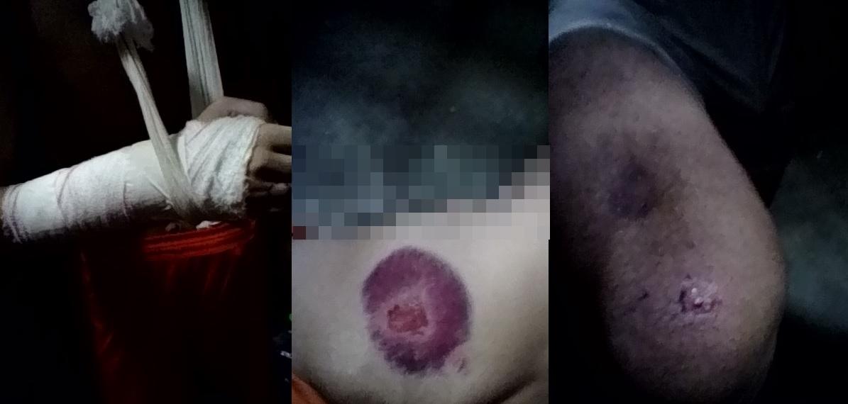 Imagens mostram presos agredidos no braço, nádegas e perna, em um presídio no Ceará.