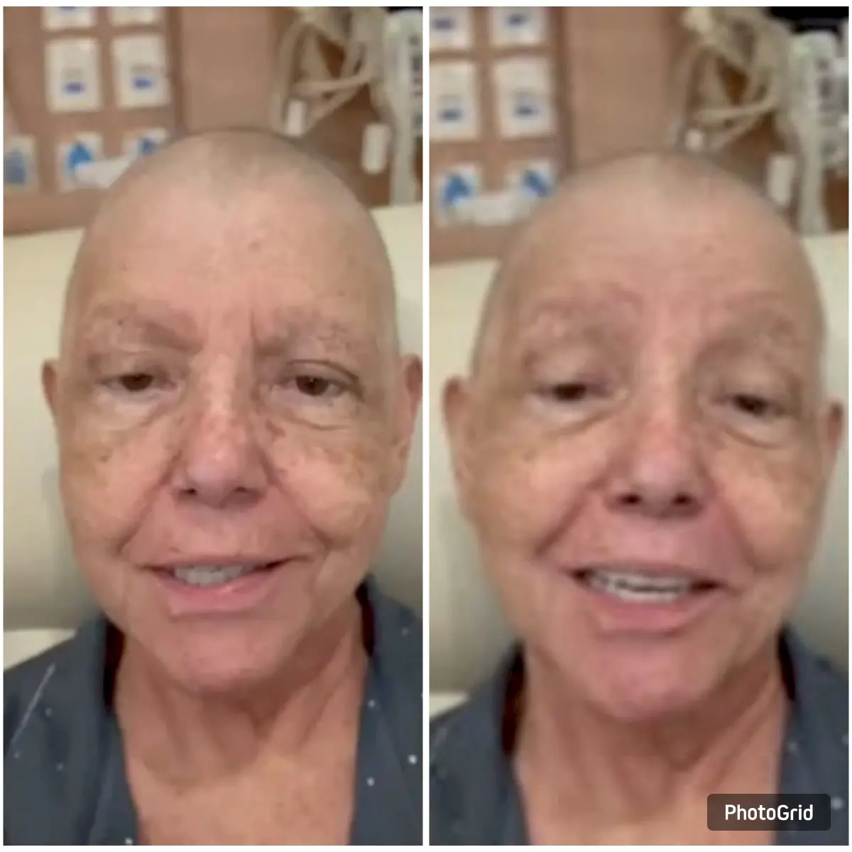 Roseana Sarney internada em hospital após diagnóstico de pneumonia.