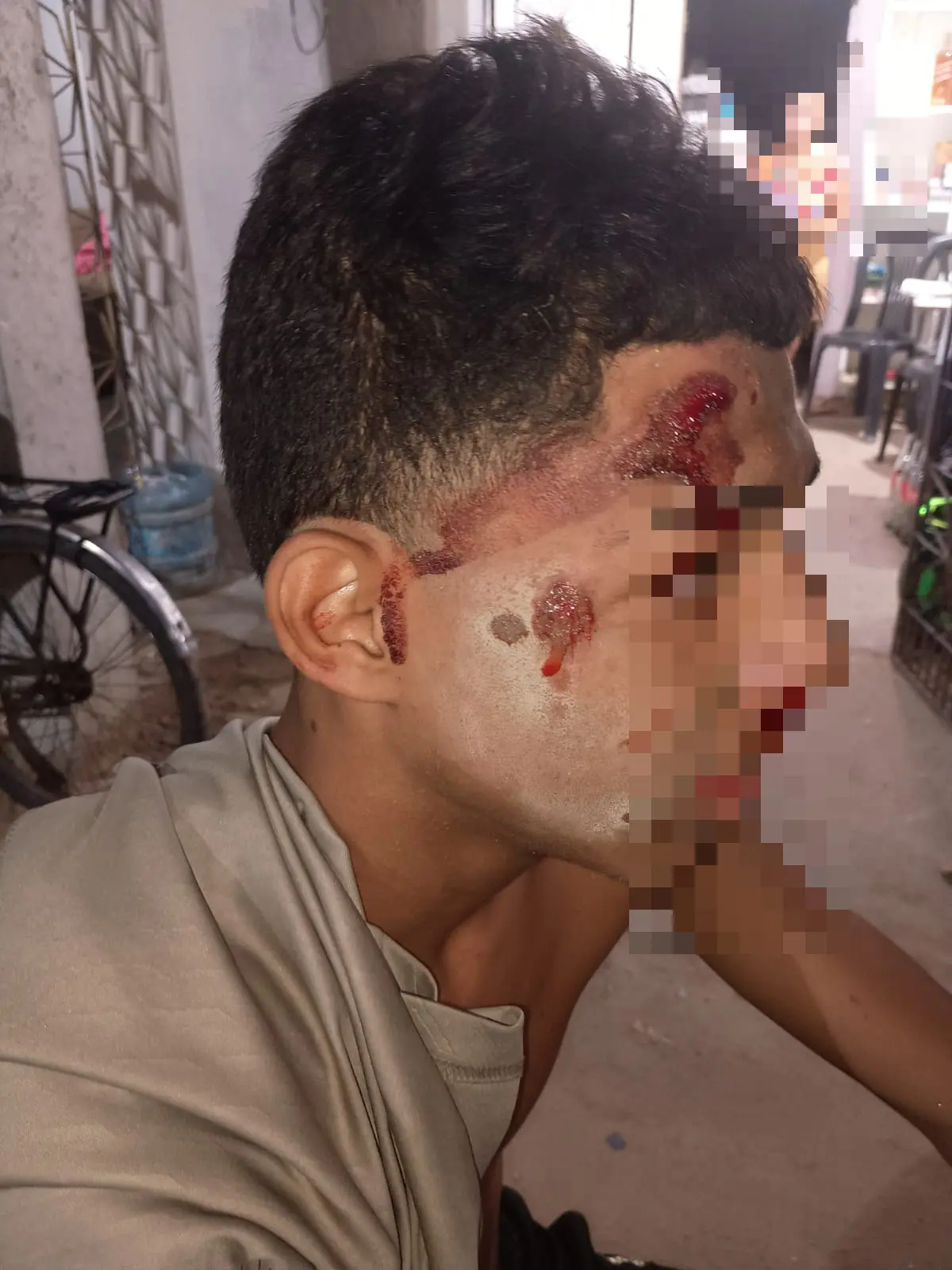 foto de jovem agredido, familia diz que foi em acao da pm, sangue e machucados no rosto.
