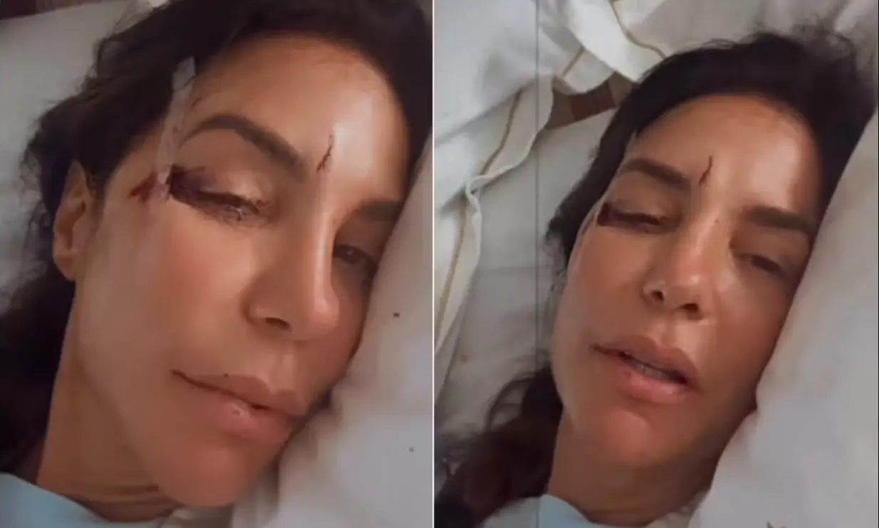 Imagem da notícia Entenda riscos da síndrome vasovagal, quadro diagnosticado em Ivete Sangalo