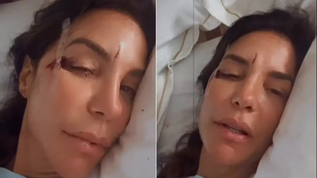 montagem de fotos da cantora Ivete Sangalo em hospital após infecção intestinal aguda.