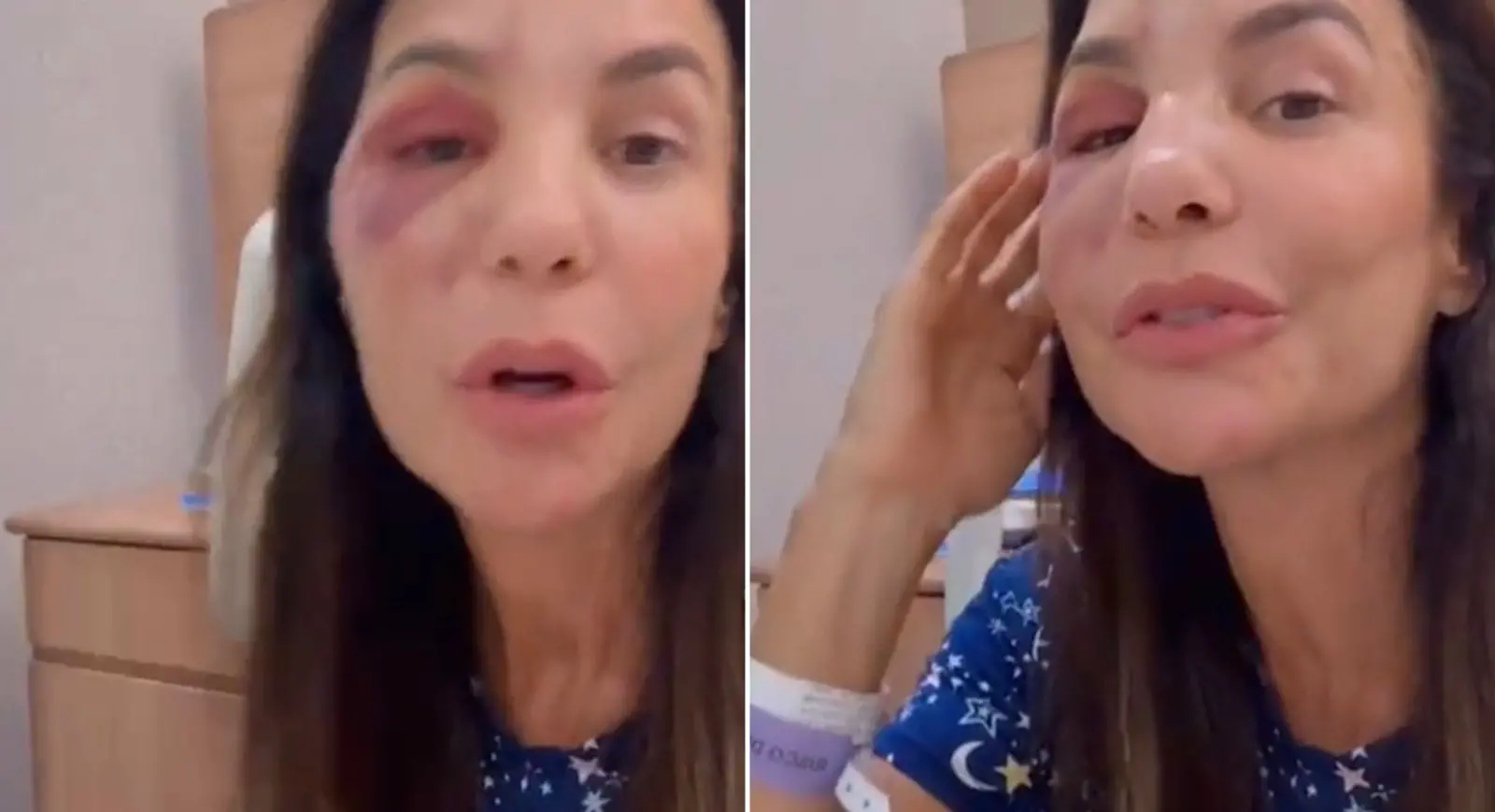 Montagem de fotos mostra Ivete Sangalo em live explicando procedimento cirúrgico.