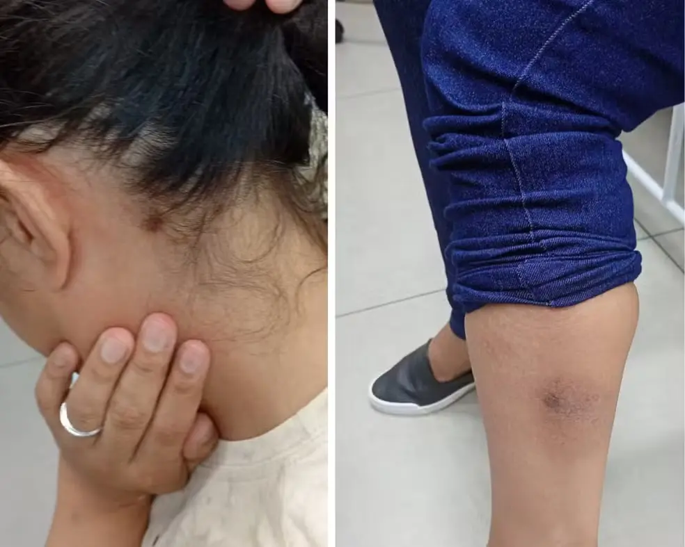 Foto de mulher agredida por marido em Araras, no interior de São Paulo.