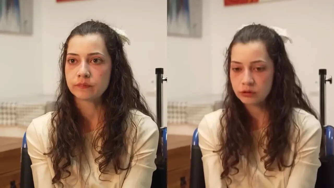 Diagnosticada com paraplegia irreversível desde 2022, Noelia Castillo Ramos, 25, teve o pedido de morte assistida aprovado inicialmente em julho de 2024.