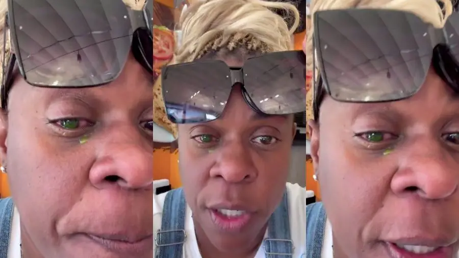 Cacau Protásio chegou a ficar com o olho verde devido o uso da pomada. 