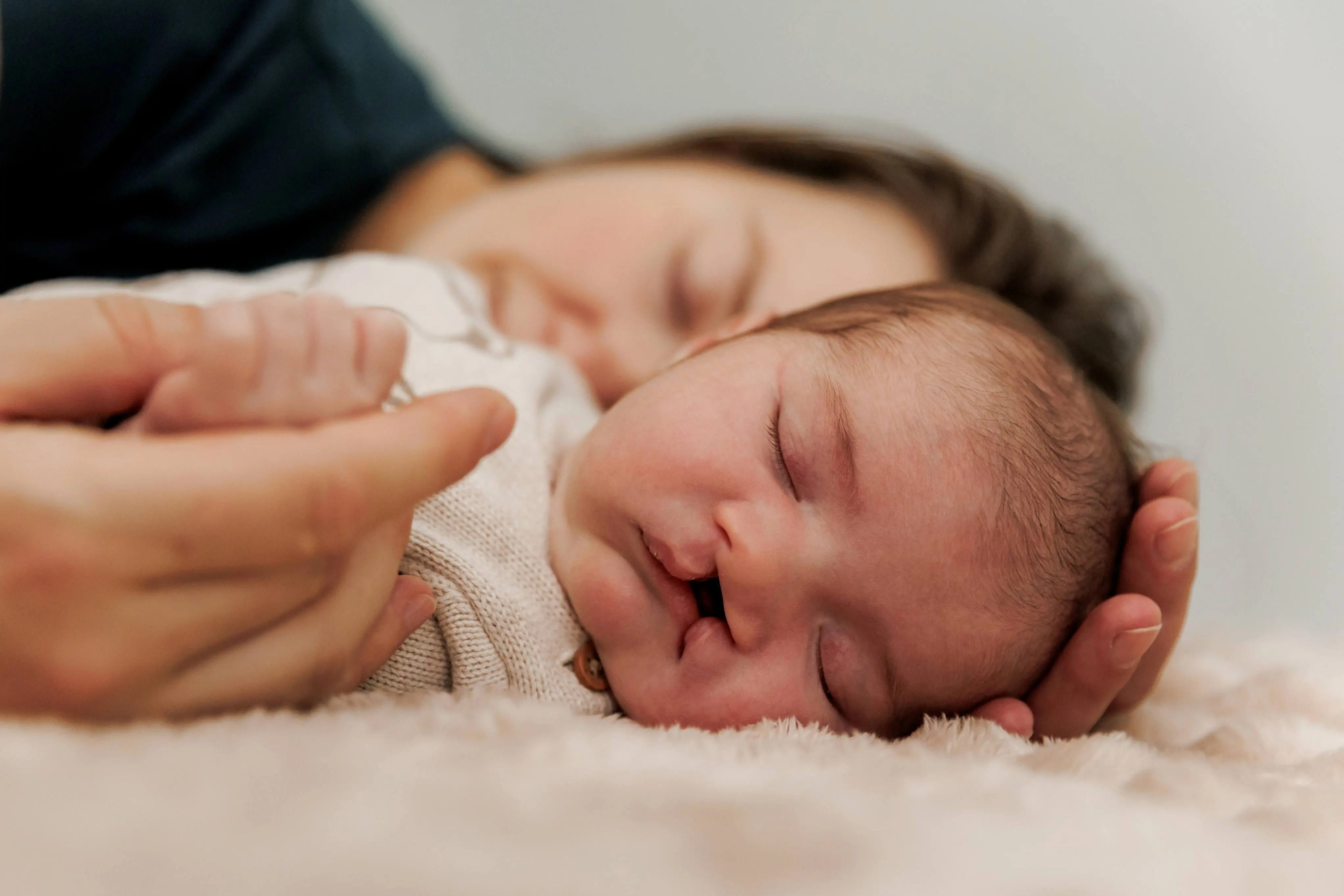 Imagem de um bebê que tem fissura de lábio e palato.