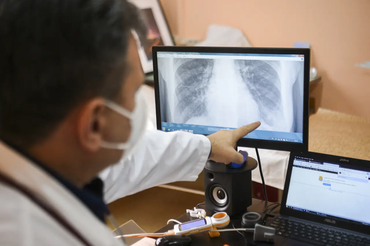 O médico e pneumologista búlgaro Alexander Simidchiev examina uma radiografia de pulmões no Instituto Médico do Ministério do Interior, em Sófia, em 26 de novembro de 2020.