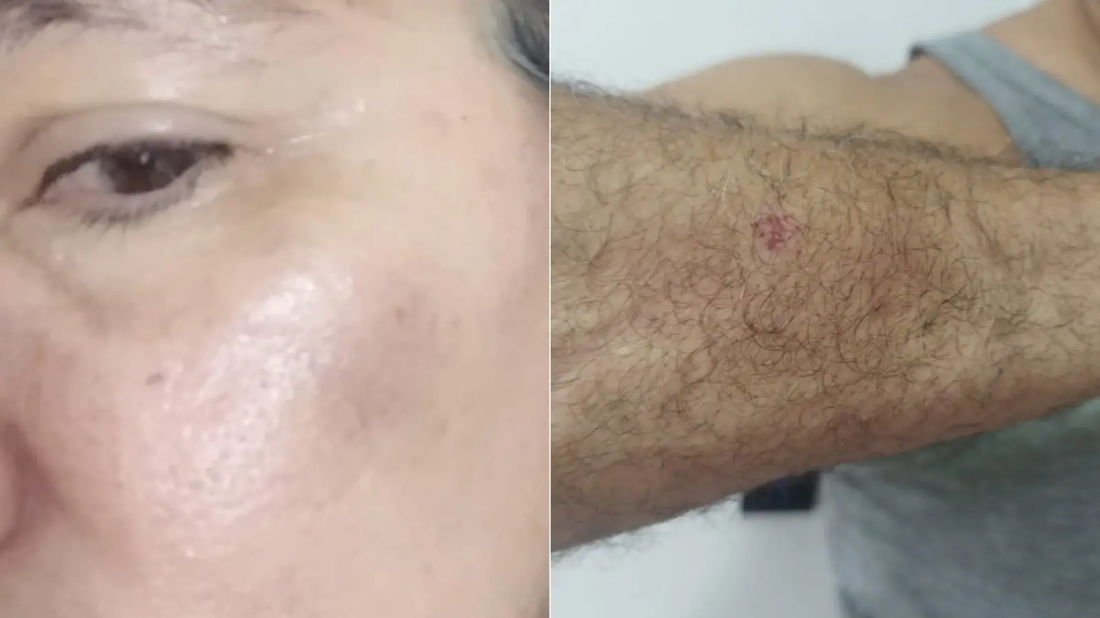 Montagem de fotos mostra agressões sofridas por vítimas.