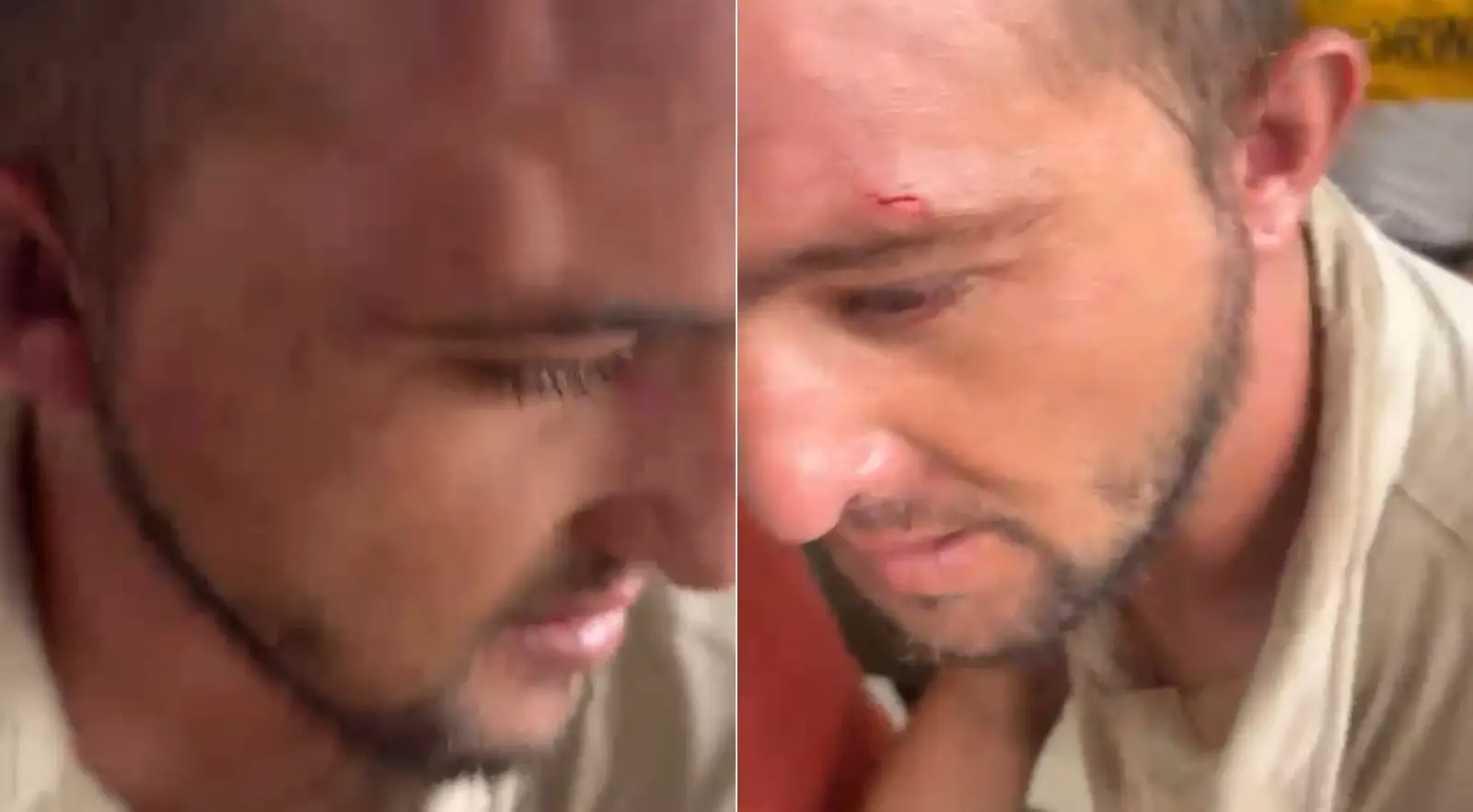 Montagem de duas fotos mostra os ferimentos do cigano Gustavo, agredido na cabeça por moradores da praia de Flecheiras.