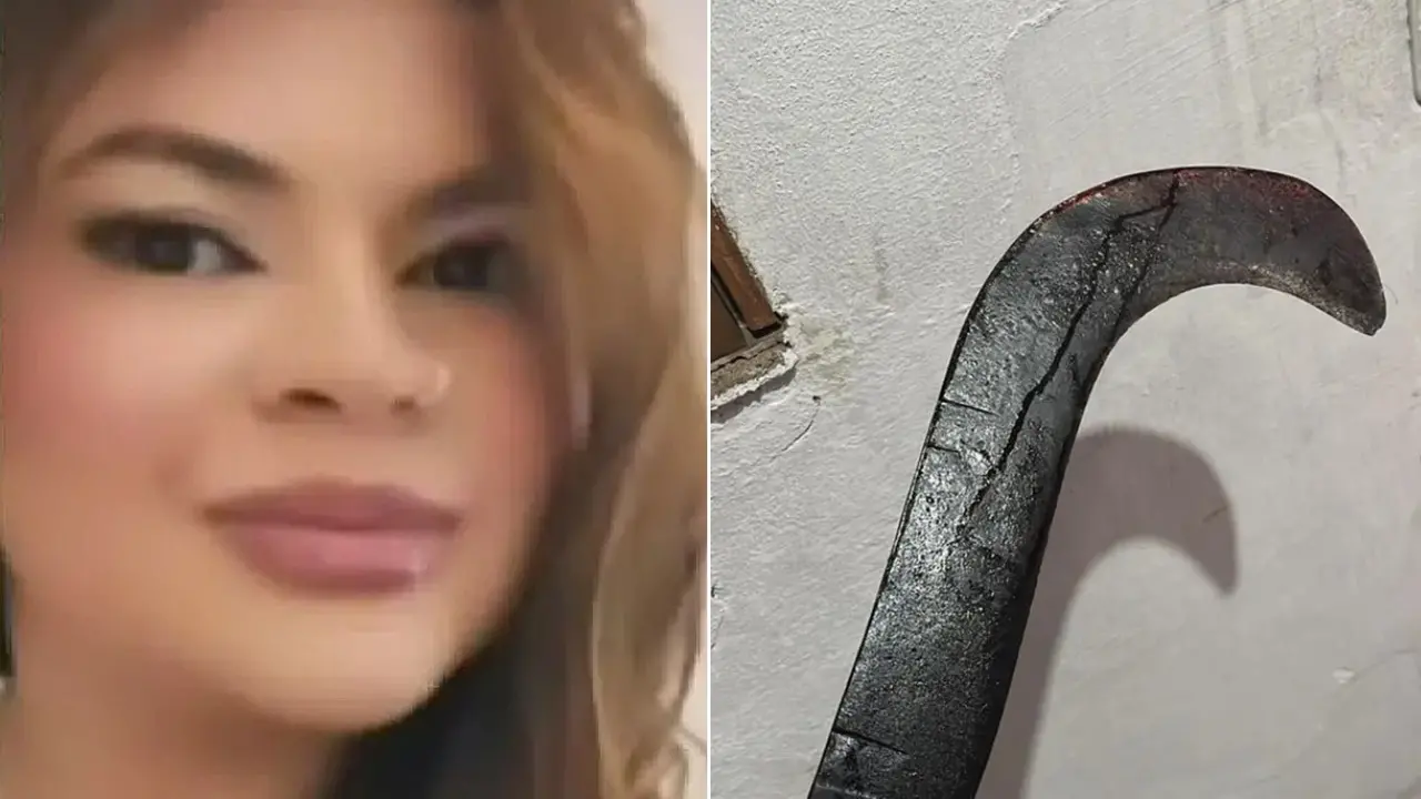 A jovem teve uma das mãos totalmente amputada e a outra permaneceu ligada ao corpo apenas por tecidos.
