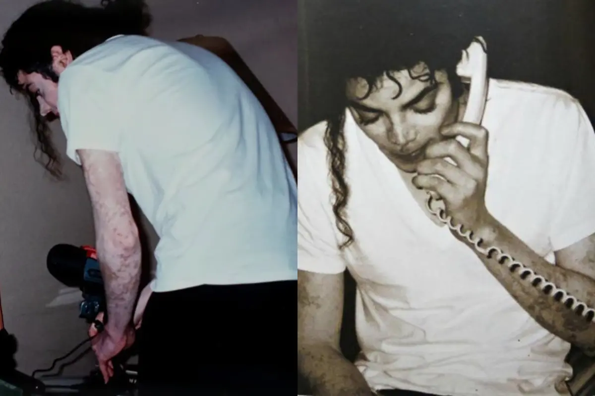 Imagens de Michael Jackson para ilustrar evergreen sobre vitiligo.