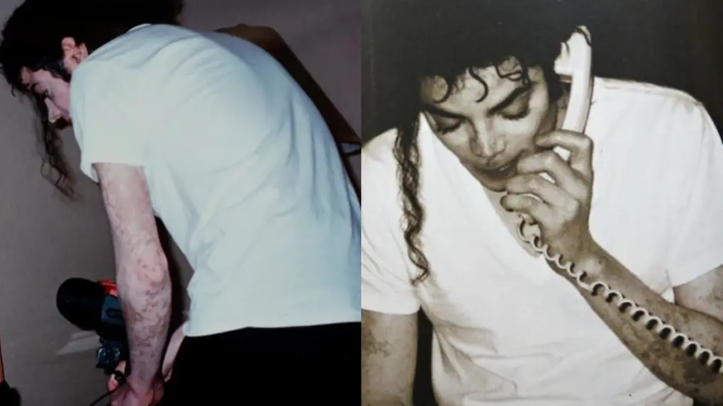 Imagens de Michael Jackson para ilustrar evergreen sobre vitiligo.