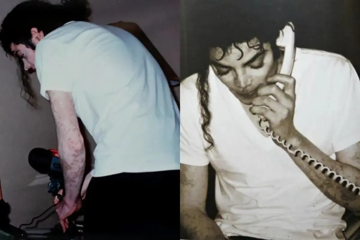Imagens de Michael Jackson para ilustrar matéria sobre vitiligo.