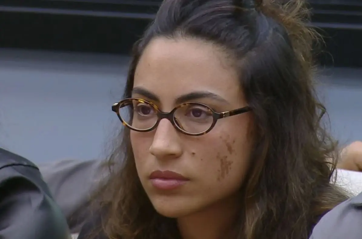 Pessoa de óculos redondos sentada em ambiente interno, com cabelo preso parcialmente e manchas visíveis na lateral do rosto, olhando para frente; fundo desfocado com outras pessoas ao redor.
