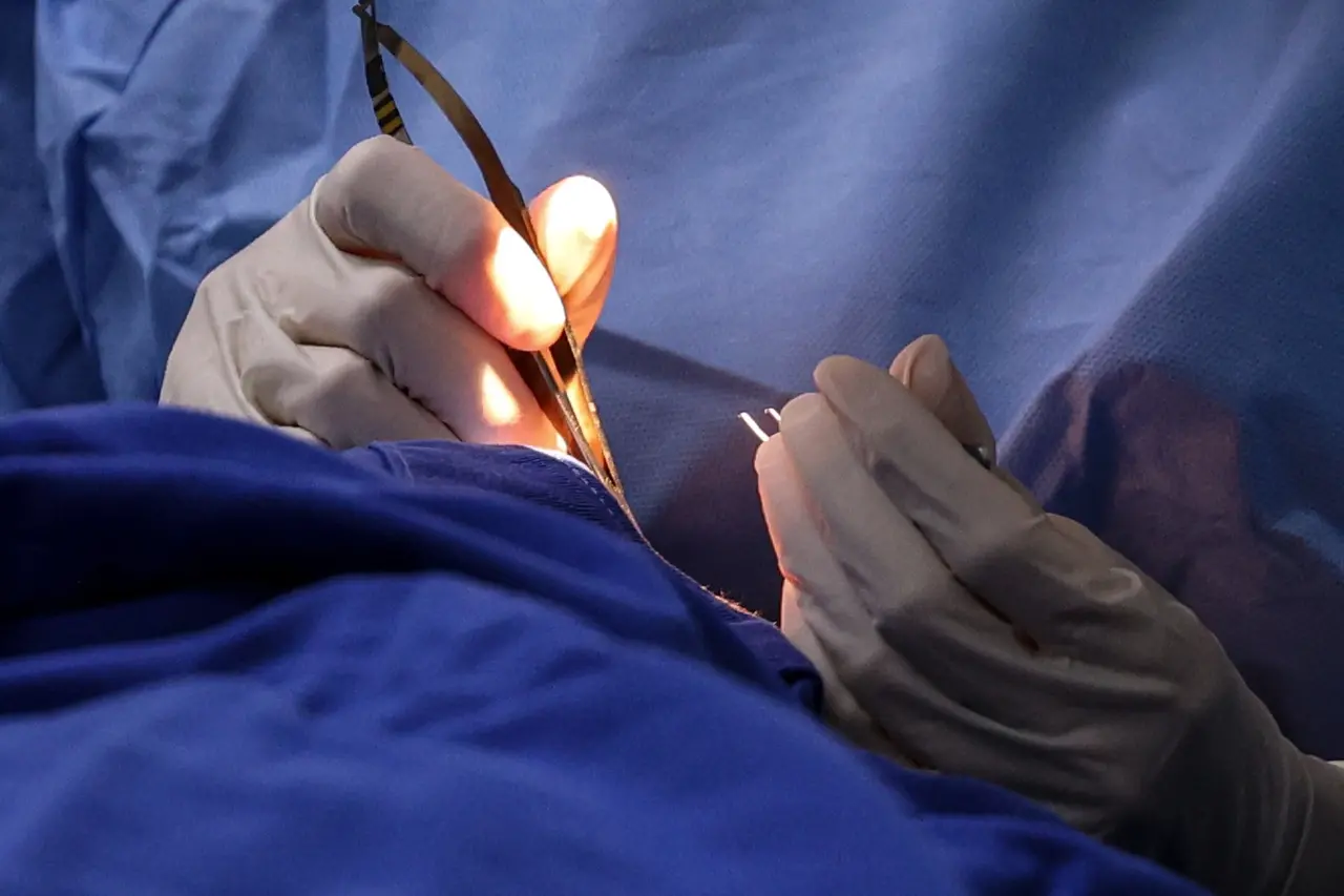 mãos com luvas cirúrgicas mexendo com pinças.