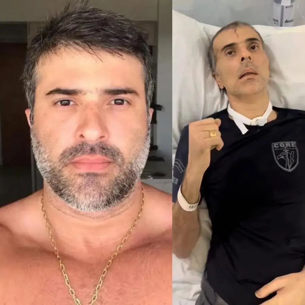 Montagem de fotos do policial civil Felipe Marques, baleado na testa durante operação no Rio de Janeiro.