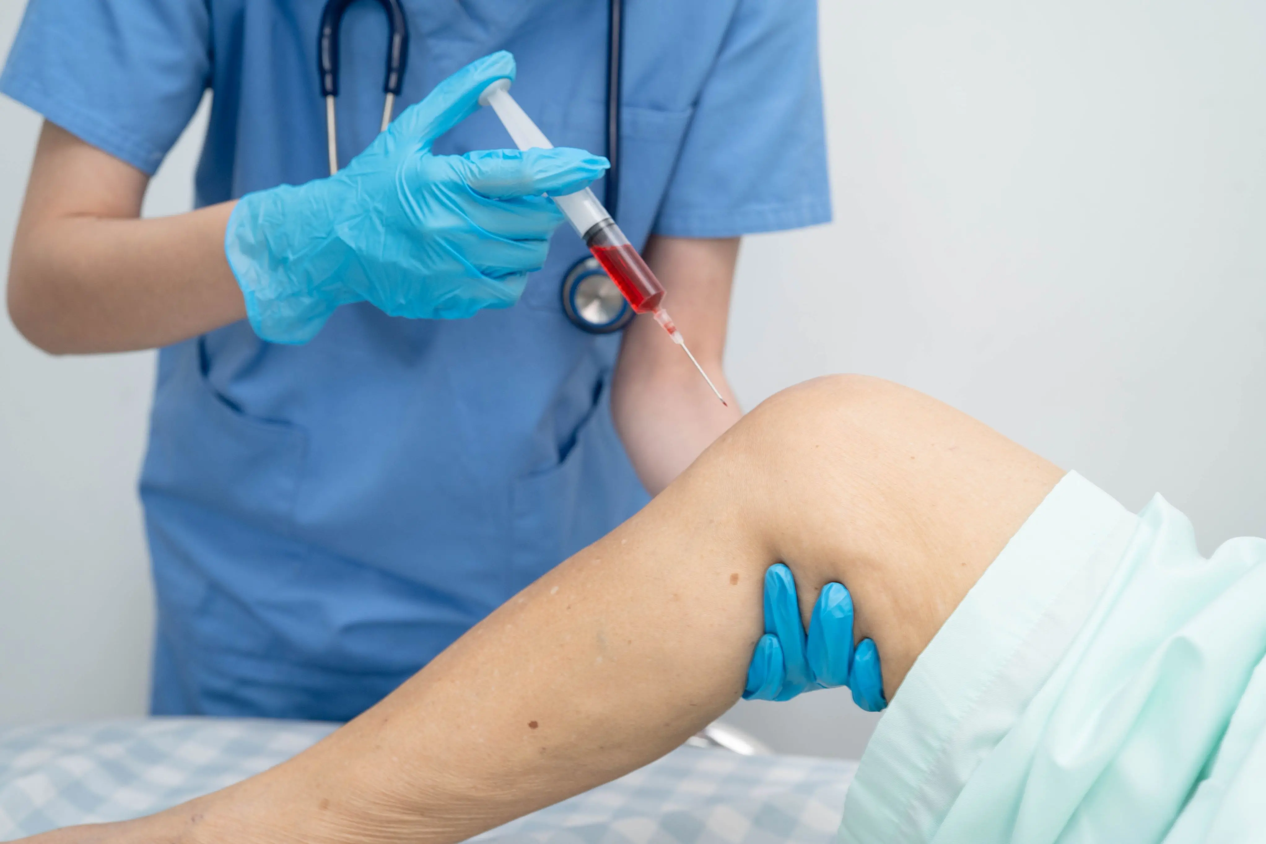 Imagem de uma pessoa colocando o Plasma Rico em Plaquetas para ilustrar matéria sobre artrose.