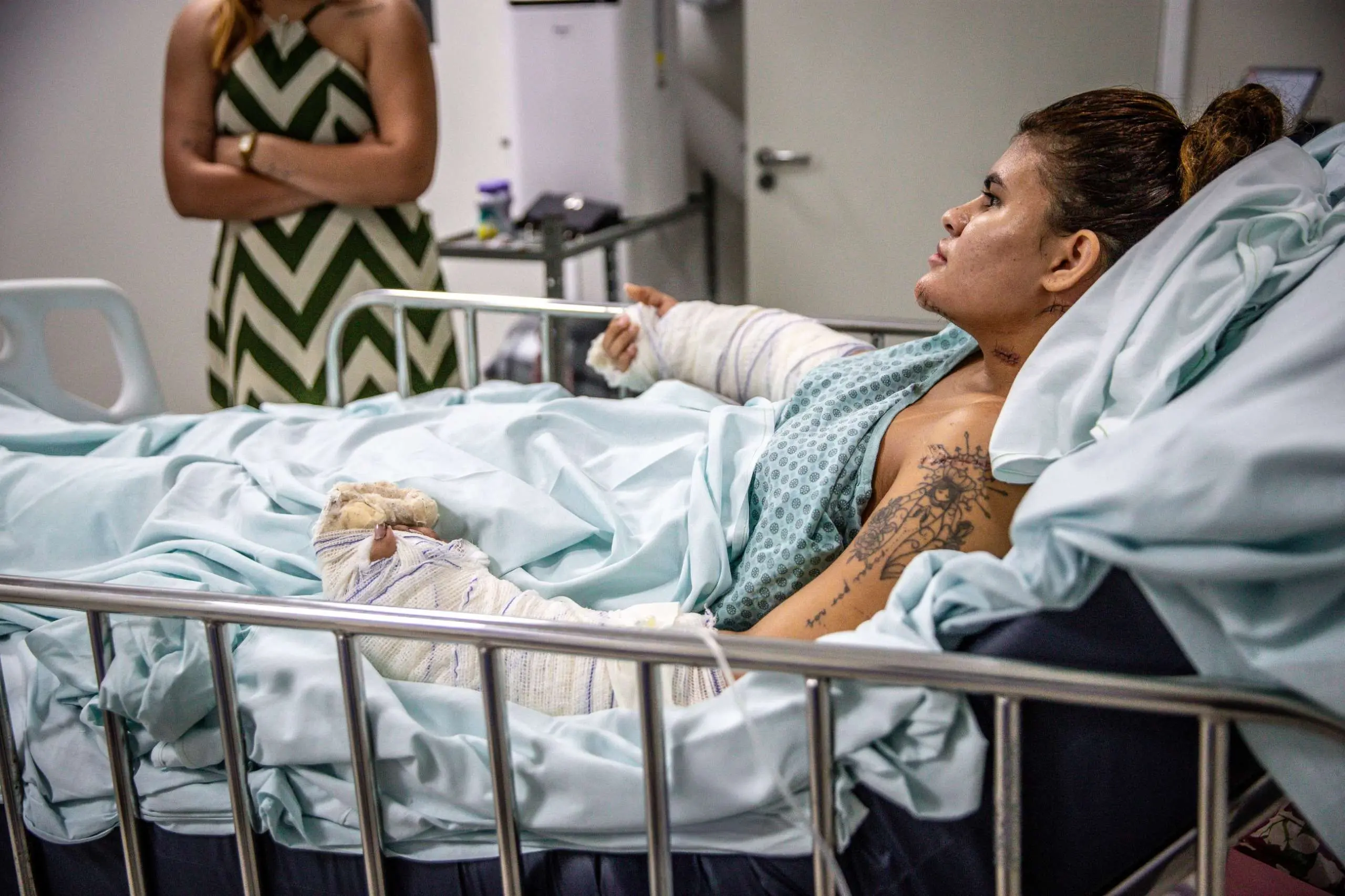 Foto de Ana Clara Oliveira, jovem que teve as mãos decepadas a mando do ex namorado no Ceará. deitada em cama de hospital. Ela está com os dois braços enfaixados até as mãos, que foram reimplantadas e cirurgias.