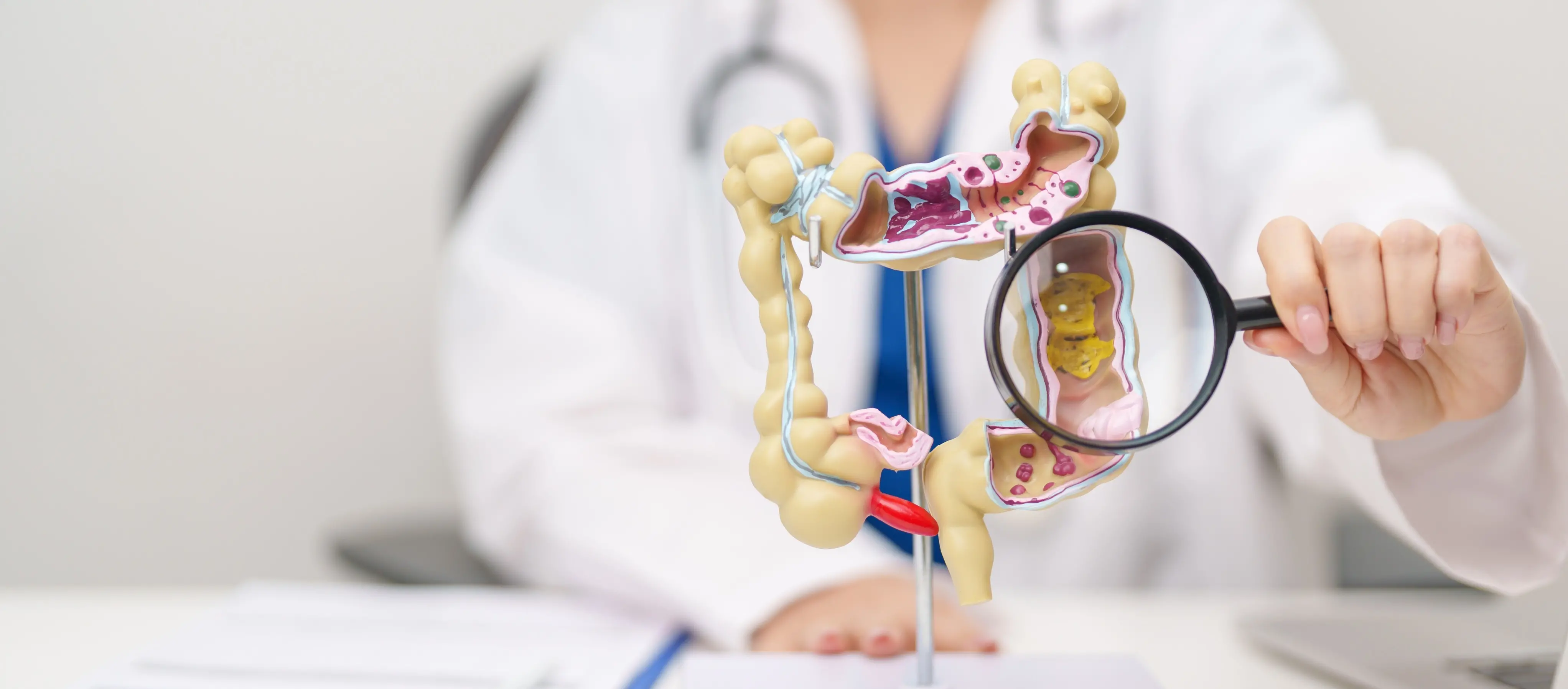 Imagem de uma maquete de intestino para ilustrar matéria sobre SUS passa a oferecer novo exame para detectar câncer de intestino precocemente.