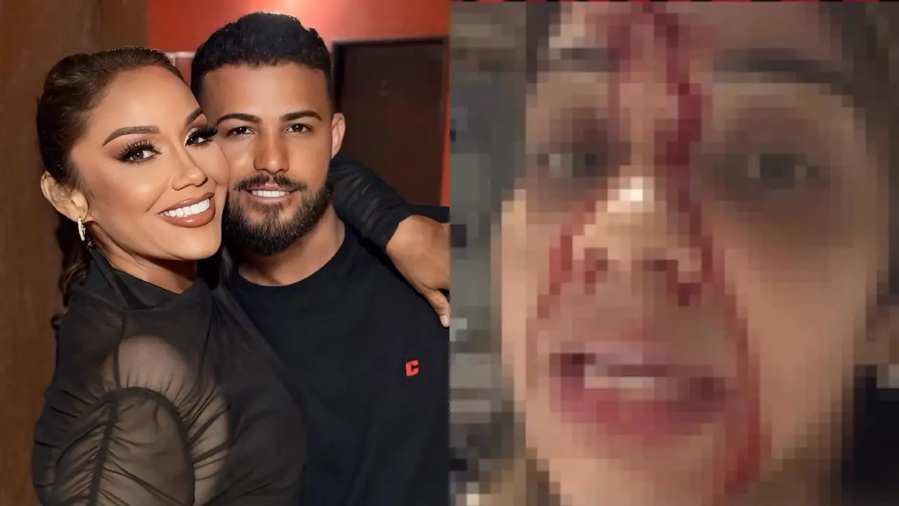 Imagem da notícia Cantora de forró afirma ter sofrido agressões de ex; baterista desmente acusações