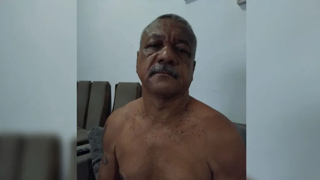 Marcado julgamento de homem acusado de decepar a orelha da mulher em Fortaleza