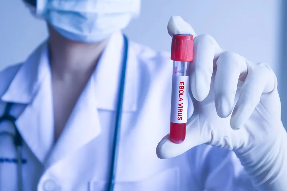 Na imagem, plano próximo de um profissional médico, de jaleco branco e máscara facial azul, segurando um tubo de coleta de sangue com tampa vermelha em uma mão com luva de látex. O rótulo branco no tubo apresenta o texto 