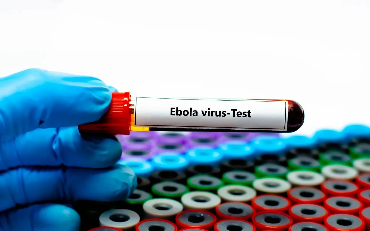 Uma mão com luva médica azul segura horizontalmente um tubo de ensaio com tampa vermelha contendo uma amostra de sangue, destacando a etiqueta branca com a inscrição 