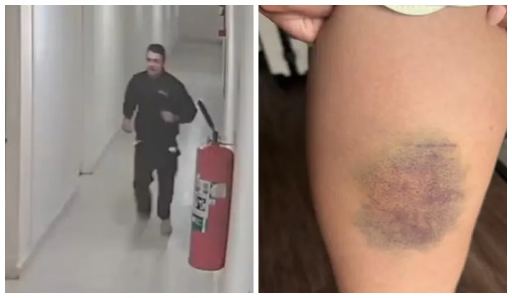 A vítima sofreu ferimentos pelo corpo, e foi encaminhada para um pronto-socorro da região. Agressor foi preso.
