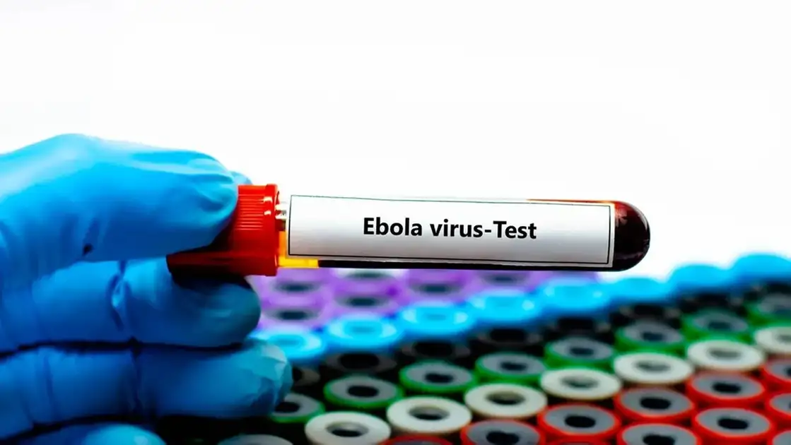 Secretaria de Saúde de SP investiga segundo caso suspeito de Ebola