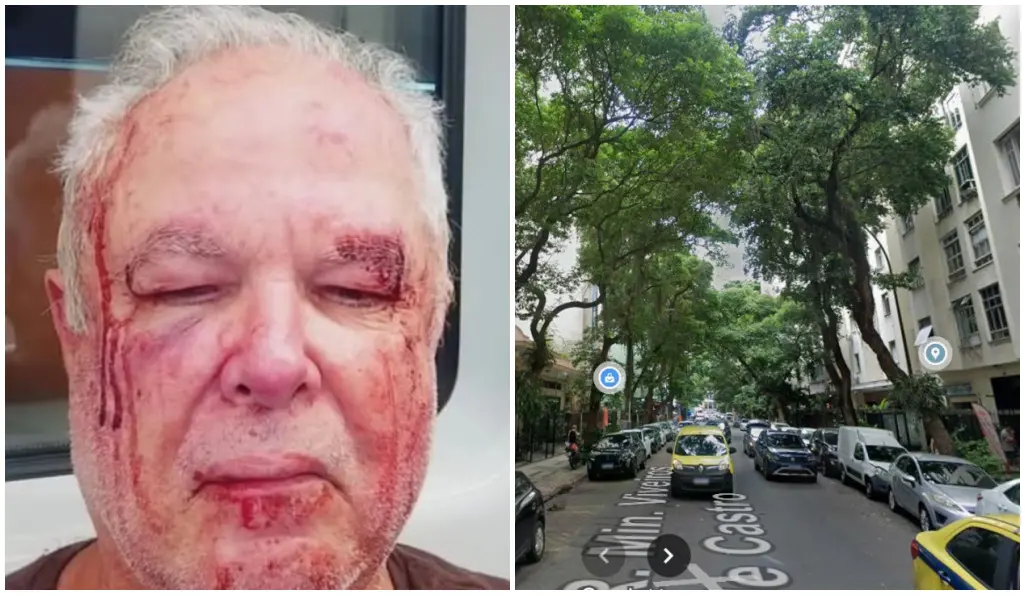 Montagem com duas imagens lado a lado. À esquerda, uma pessoa idosa aparece em close-up com ferimentos visíveis no rosto, incluindo cortes, hematomas e sangue escorrendo pela testa, ao redor dos olhos e pela bochecha. À direita, vista de uma rua arborizada em área urbana, com carros estacionados dos dois lados, alguns veículos em circulação e prédios residenciais parcialmente visíveis entre as árvores. A justaposição das imagens sugere uma possível relação entre a pessoa ferida e o local mostrado.