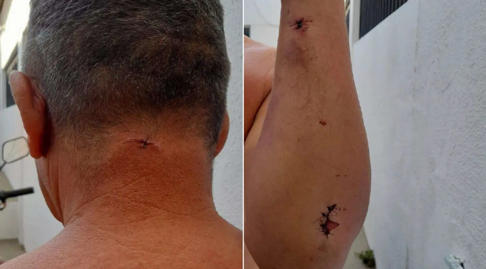 Montagem de duas fotos mostra vítima com perfurações na nuca e nos braços.