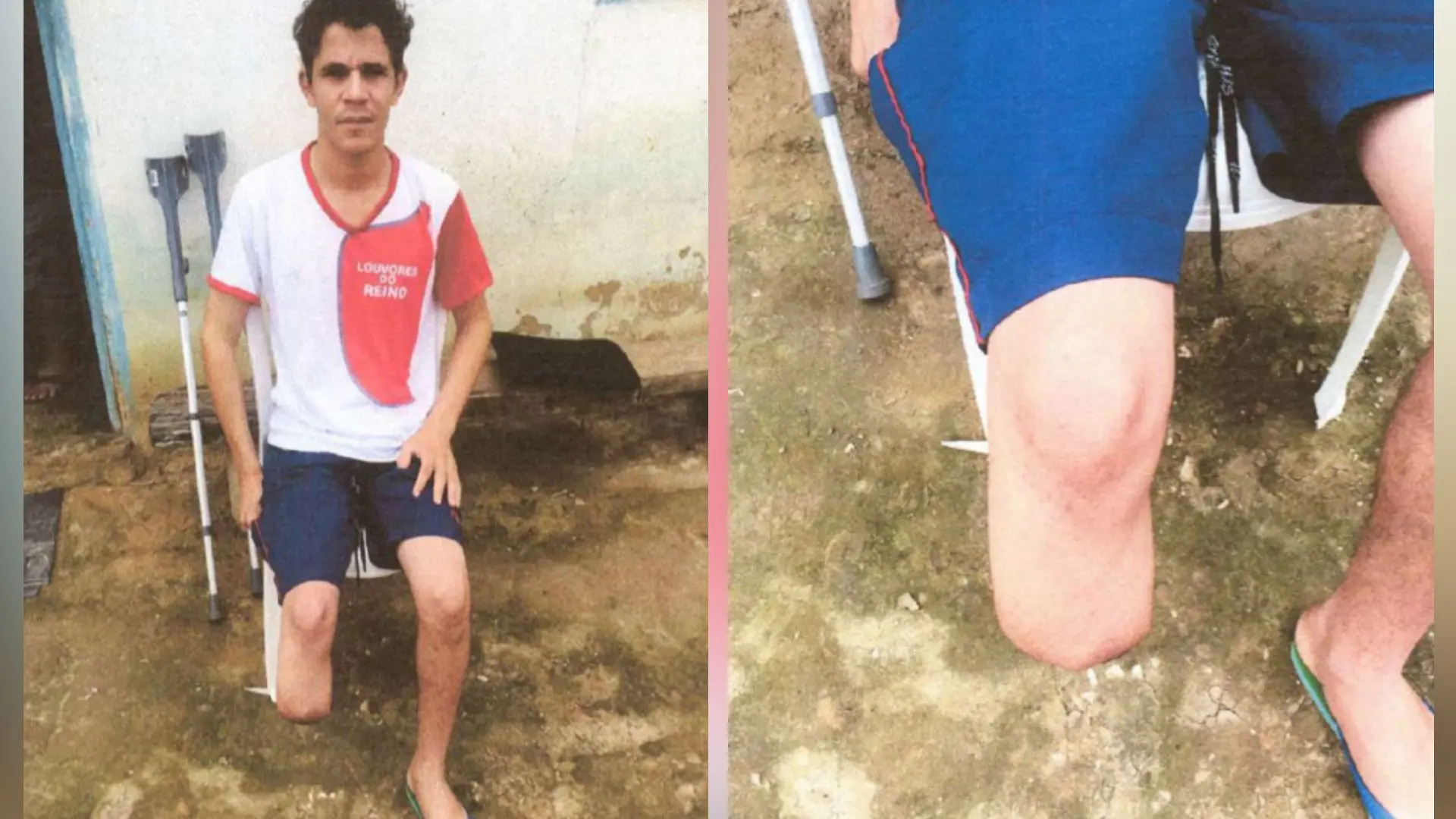 imagem de um homem sem o pé direito sentando em uma cadeira