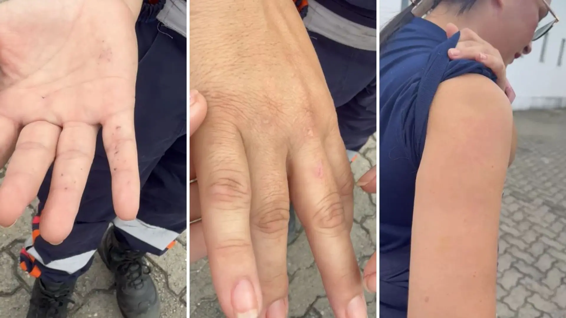 Imagem da notícia Técnica do SAMU é agredida por paciente durante atendimento no Conjunto Palmeiras, em Fortaleza