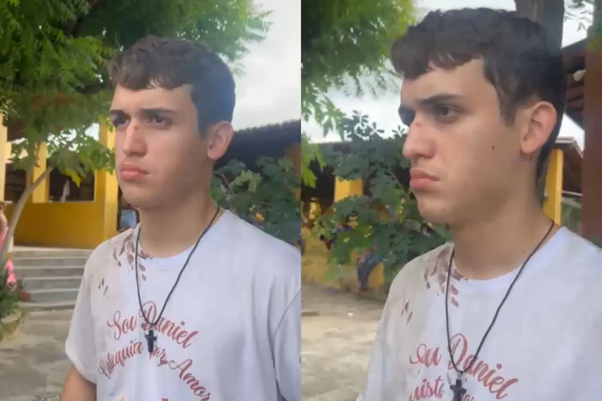 Imagem da notícia Sobrevivente de acidente com ônibus de romeiros em Canindé ajudou no resgate de outras vítimas