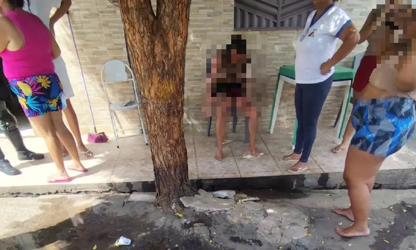 Imagem da notícia Homem que ateou fogo à namorada no Cariri agiu por ciúme e ainda deu soco no rosto da mulher