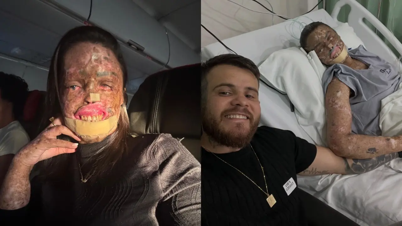 Imagem da notícia Morre Karine Felipe, influnenciadora cearense que tinha doença rara 