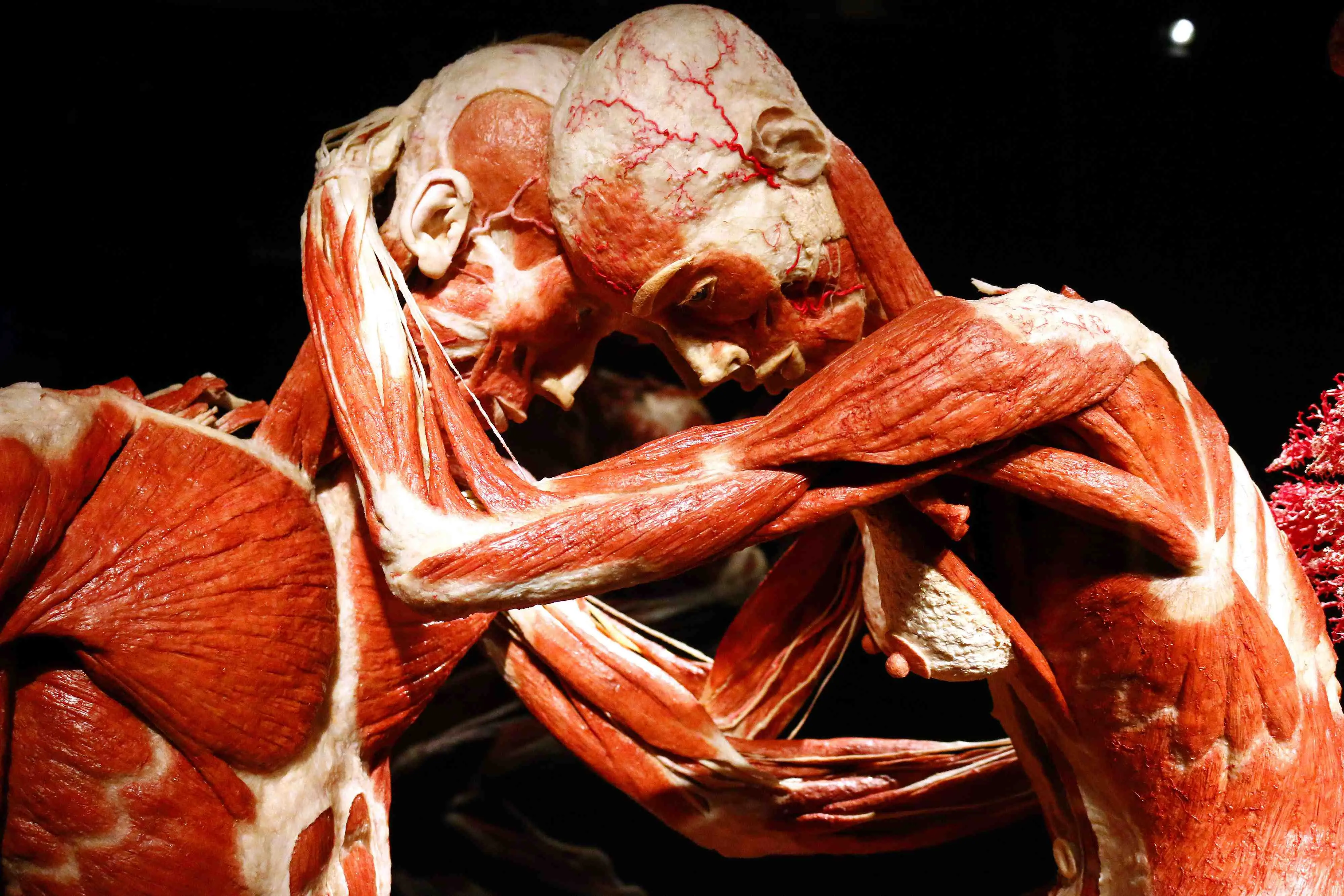 Morre anatomista Gunther von Hagens, conhecido por exposição de corpos humanos