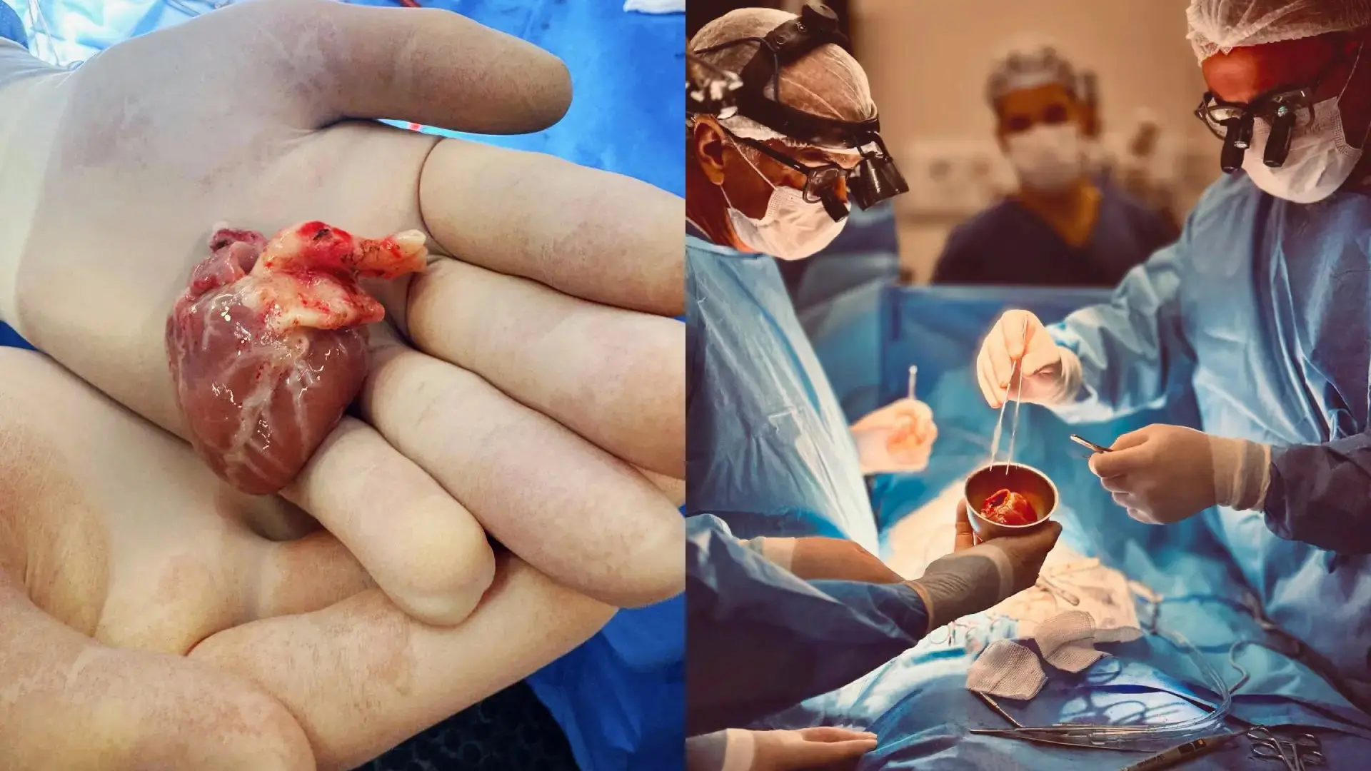 Imagem da notícia Hospital Universitário do Ceará realiza dois primeiros transplantes cardíacos pediátricos