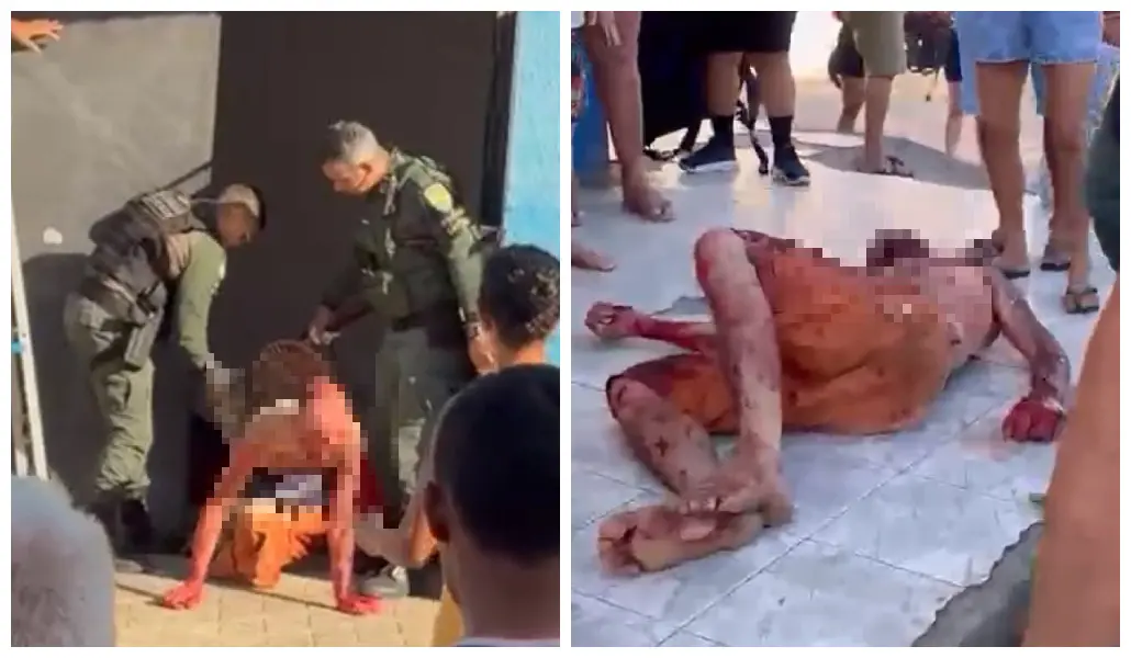 Imagem da notícia Homem é atacado pelo próprio pitbull no bairro Mondubim, em Fortaleza