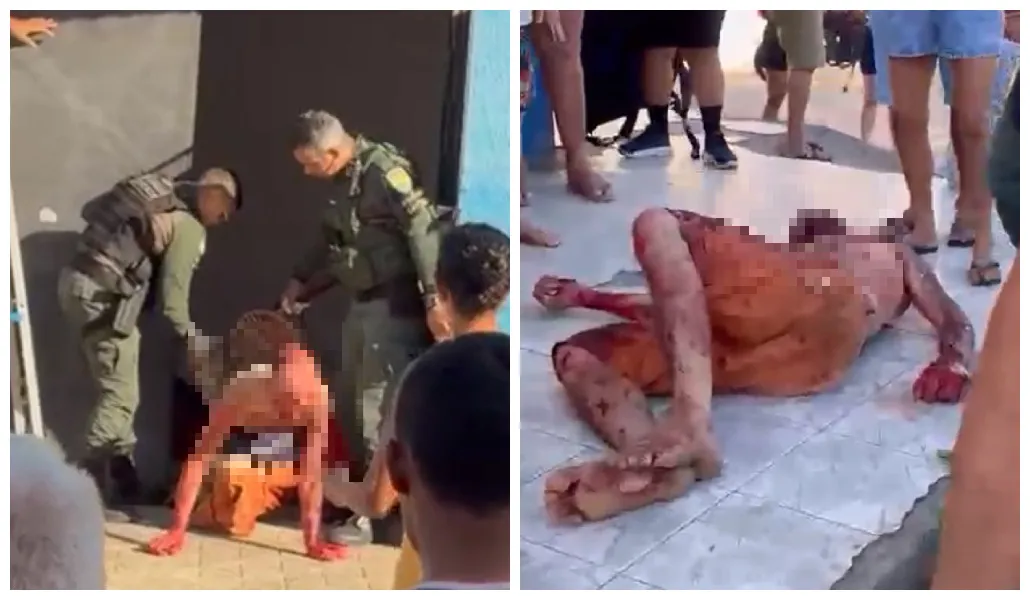 Homem aparece com diversos ferimentos após ataque de pitbull.