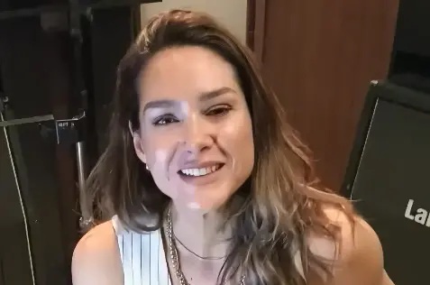 Imagem da notícia Fernanda Machado relembra grave problema de saúde; veja por onde anda atriz