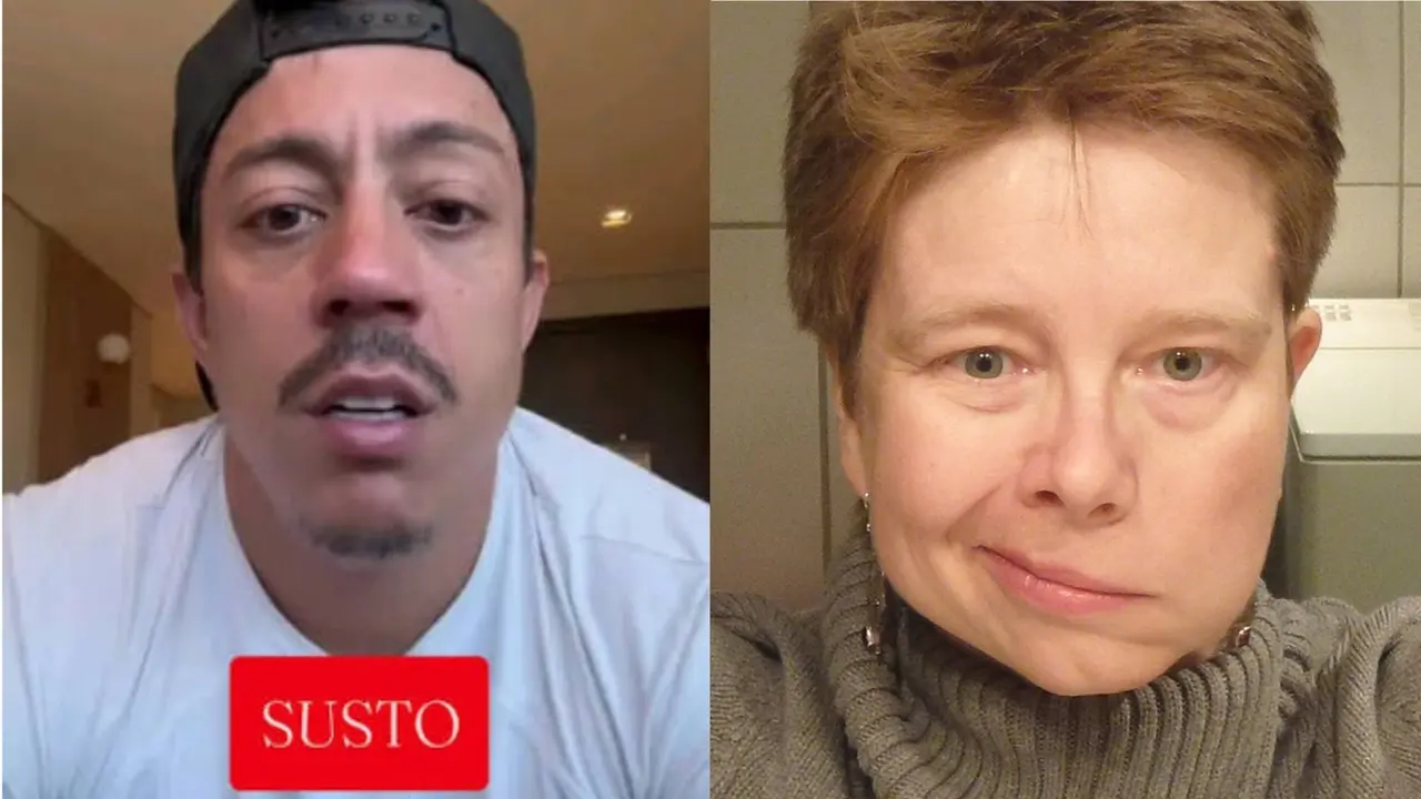 Imagem da notícia O que é paralisia de Bell, doença do humorista Renato Albani
