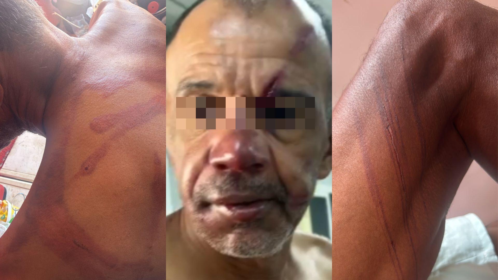 Imagem da notícia Baiano denuncia tentativa de homicídio e racismo em barraca da Praia do Futuro