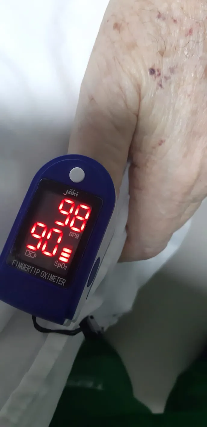 A rotina nas unidade inclui monitorar oxímetros para medir o nível de oxigênio no sangue dos pacientes