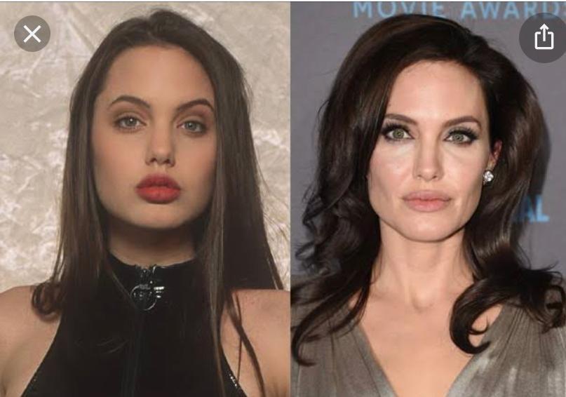 Atriz Angelina Jolie, que na adolescência teve rosto cheio e, hoje, vemos o afinamento no terço inferior do rosto.