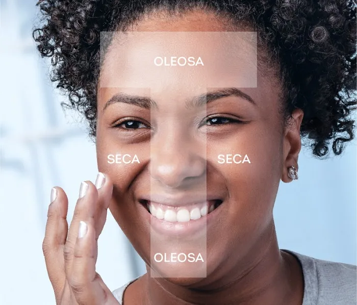 Pele mista e região “T”.