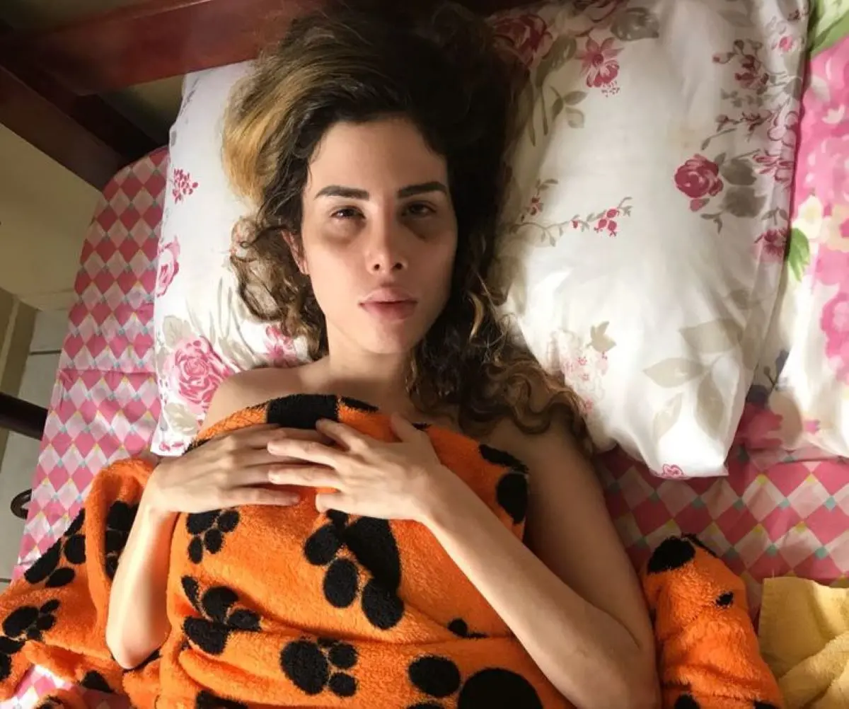 Camilla Uckers acamada após cirurgia