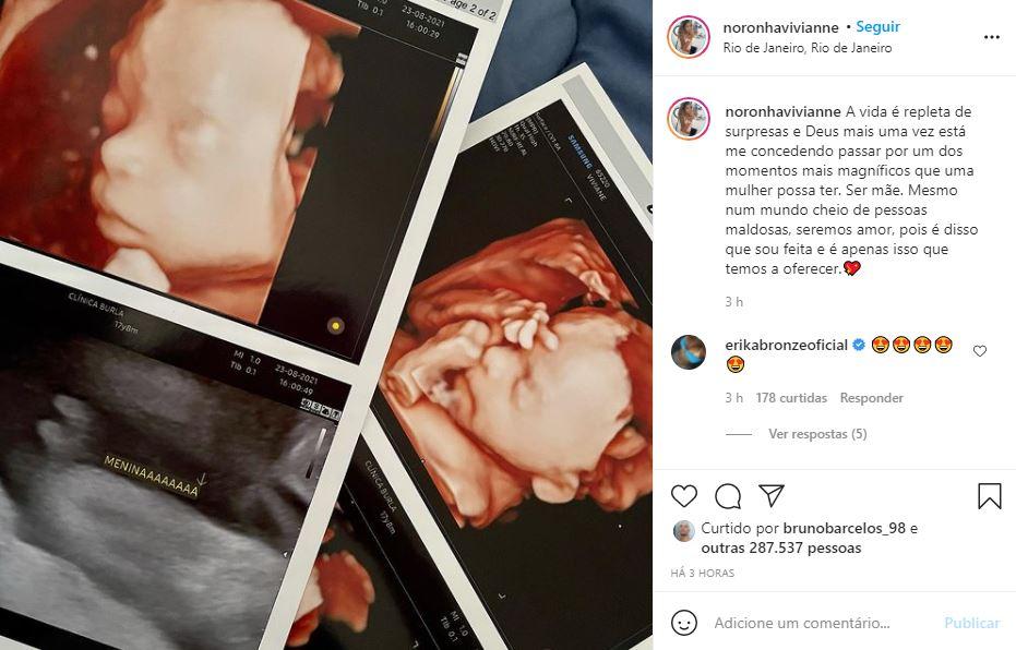 Post de Vivianne Noronha sobre terceira gravidez