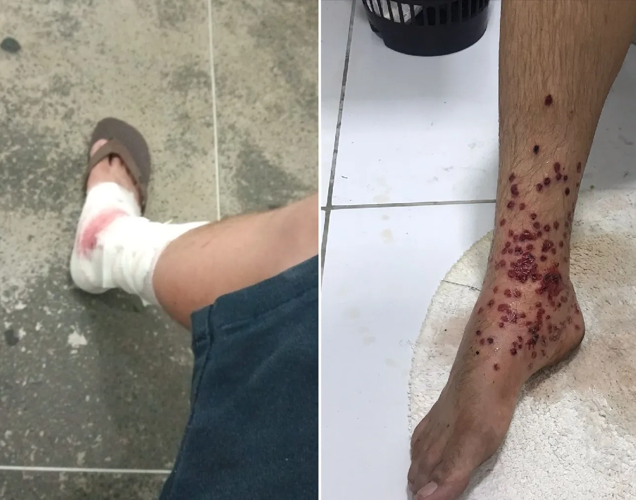 A vítima disse ter sido atingida por um disparo no pé. O estudando foi socorrido a uma unidade hospitalar e depois levado até a delegacia
